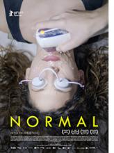 Normal